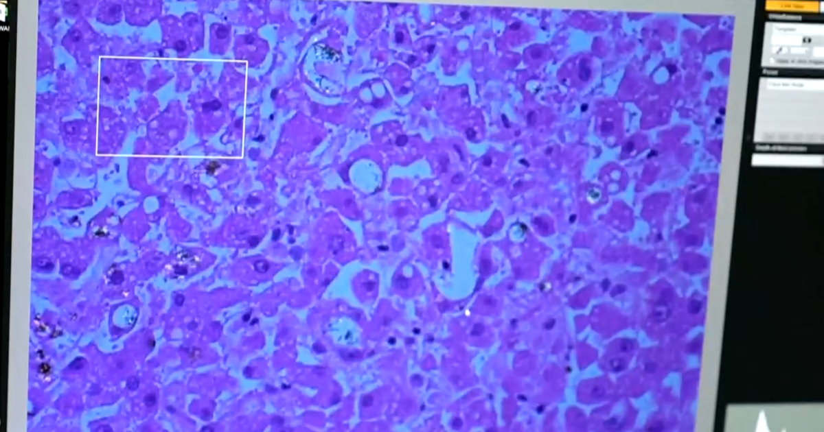 As Nanoplasties can be impact our long-term health