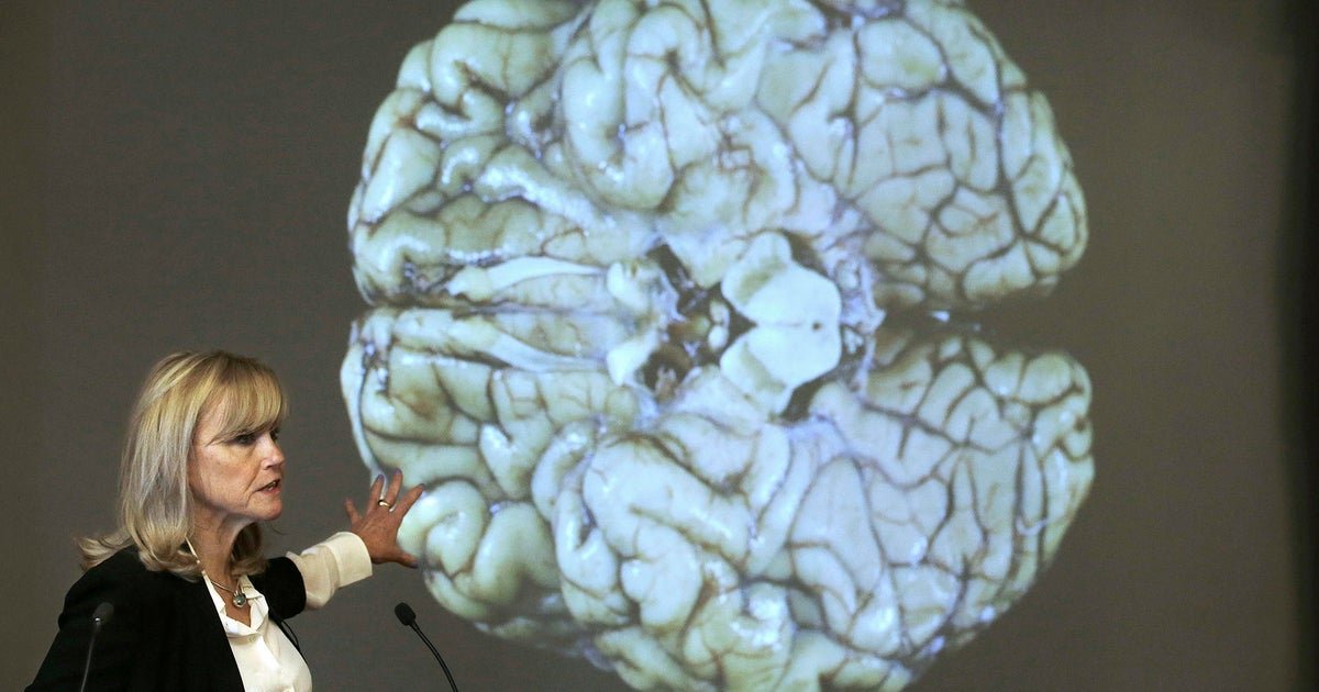 What is CTE, the condition of the brain referred to by Midtown Manhattan Shooter shoops?