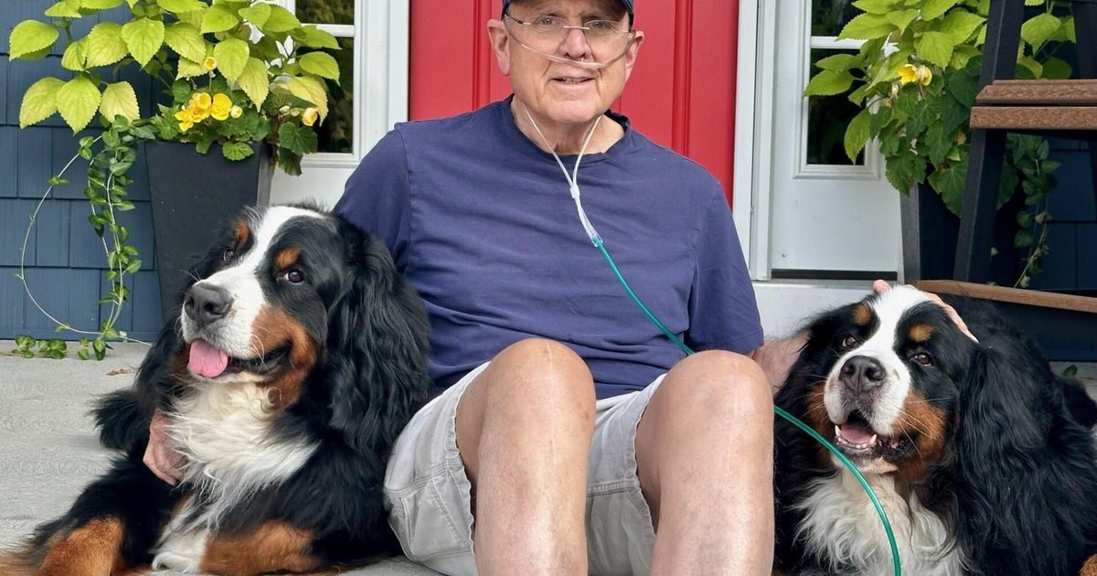 A dog trainer had no symptoms. A scan of their lungs found a terminal disease